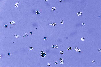 lebende und tote Hefen, Bildquelle: J. Muno-Bender